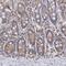 Protein Kinase C Delta antibody, NBP1-90351, Novus Biologicals, Immunohistochemistry paraffin image 