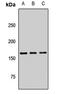 Secretory phospholipase A2 receptor antibody, LS-C668183, Lifespan Biosciences, Western Blot image 