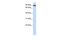 Transferrin Receptor 2 antibody, PA5-42732, Invitrogen Antibodies, Western Blot image 