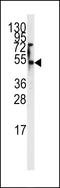 Solute Carrier Family 29 Member 1 (Augustine Blood Group) antibody, LS-B8989, Lifespan Biosciences, Western Blot image 