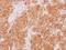 WD Repeat Domain 77 antibody, GTX116802, GeneTex, Immunohistochemistry paraffin image 