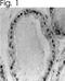 Estrogen Receptor 2 antibody, PA1-313, Invitrogen Antibodies, Immunohistochemistry paraffin image 