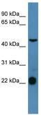 Somatostatin Receptor 1 antibody, TA342651, Origene, Western Blot image 