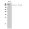 Ephrin type-A receptor 2 antibody, LS-C381140, Lifespan Biosciences, Western Blot image 