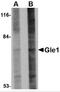 GLE1 RNA Export Mediator antibody, 4973, ProSci, Western Blot image 