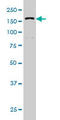 DExH-Box Helicase 9 antibody, LS-B5394, Lifespan Biosciences, Western Blot image 