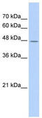 TATA-Box Binding Protein Associated Factor 7 Like antibody, TA335457, Origene, Western Blot image 