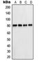 Phosphofructokinase, Liver Type antibody, orb214384, Biorbyt, Western Blot image 