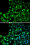 O-6-Methylguanine-DNA Methyltransferase antibody, STJ24549, St John