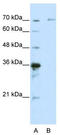 Interleukin 1 Receptor Associated Kinase 3 antibody, TA343776, Origene, Western Blot image 