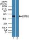 Zinc Finger And BTB Domain Containing 2 antibody, PA5-23440, Invitrogen Antibodies, Western Blot image 