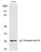Cyclin Dependent Kinase Inhibitor 1B antibody, PA5-40207, Invitrogen Antibodies, Western Blot image 