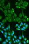 Fatty Acid Binding Protein 4 antibody, LS-C330854, Lifespan Biosciences, Immunofluorescence image 