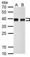 Heterogeneous Nuclear Ribonucleoprotein C (C1/C2) antibody, GTX113463, GeneTex, Western Blot image 