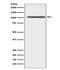 ADAM Metallopeptidase Domain 17 antibody, M00604, Boster Biological Technology, Western Blot image 