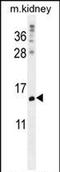 MORN Repeat Containing 5 antibody, PA5-71653, Invitrogen Antibodies, Western Blot image 