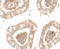 Interleukin 1 Receptor Like 2 antibody, A09203, Boster Biological Technology, Immunohistochemistry paraffin image 