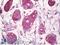 Core-Binding Factor Subunit Beta antibody, LS-B7059, Lifespan Biosciences, Immunohistochemistry paraffin image 