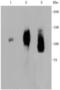 Lysosomal Associated Membrane Protein 2 antibody, A01573-2, Boster Biological Technology, Western Blot image 