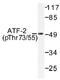 Activating Transcription Factor 2 antibody, AP01532PU-N, Origene, Western Blot image 