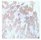 Fms Related Tyrosine Kinase 3 antibody, GTX79073, GeneTex, Immunohistochemistry paraffin image 