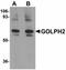 Golgi Membrane Protein 1 antibody, orb89843, Biorbyt, Western Blot image 