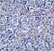 Lymphocyte Activating 3 antibody, A02869, Boster Biological Technology, Immunohistochemistry paraffin image 