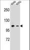 CD11b antibody, LS-C168511, Lifespan Biosciences, Western Blot image 