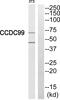 Spindle Apparatus Coiled-Coil Protein 1 antibody, PA5-39115, Invitrogen Antibodies, Western Blot image 