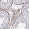 F-Box And Leucine Rich Repeat Protein 13 antibody, NBP2-31664, Novus Biologicals, Immunohistochemistry paraffin image 