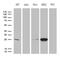 Glutathione S-Transferase Zeta 1 antibody, M03948, Boster Biological Technology, Western Blot image 