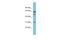 Maestro Heat Like Repeat Family Member 8 antibody, A17997, Boster Biological Technology, Western Blot image 