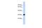 Transcription Factor A, Mitochondrial antibody, GTX44825, GeneTex, Western Blot image 