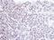 Homeobox-containing protein 1 antibody, GTX104189, GeneTex, Immunohistochemistry paraffin image 