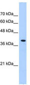 Peroxisomal Biogenesis Factor 10 antibody, TA330521, Origene, Western Blot image 
