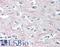 TAO Kinase 1 antibody, LS-B8589, Lifespan Biosciences, Immunohistochemistry paraffin image 