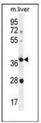 Olfactory Receptor Family 4 Subfamily A Member 15 antibody, AP53046PU-N, Origene, Western Blot image 