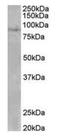 SET Domain Bifurcated Histone Lysine Methyltransferase 2 antibody, orb12393, Biorbyt, Western Blot image 