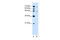 Zinc Finger FYVE-Type Containing 27 antibody, 29-992, ProSci, Enzyme Linked Immunosorbent Assay image 
