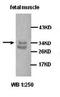 Sad1 And UNC84 Domain Containing 2 antibody, orb76820, Biorbyt, Western Blot image 