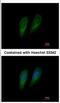 Fumarylacetoacetate Hydrolase antibody, NBP2-16546, Novus Biologicals, Immunocytochemistry image 