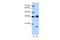 Heterogeneous Nuclear Ribonucleoprotein H3 antibody, ARP40721_T100, Aviva Systems Biology, Western Blot image 
