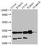 Tryptase Beta 2 (Gene/Pseudogene) antibody, CSB-PA024128LA01HU, Cusabio, Western Blot image 