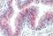 Zinc Finger DHHC-Type Containing 13 antibody, orb18960, Biorbyt, Immunohistochemistry paraffin image 