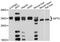 Sirtuin 5 antibody, LS-B14389, Lifespan Biosciences, Western Blot image 
