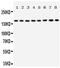 TSC Complex Subunit 1 antibody, GTX12288, GeneTex, Western Blot image 