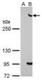 Tumor suppressor p53-binding protein 1 antibody, PA5-34675, Invitrogen Antibodies, Western Blot image 