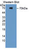 Platelet Derived Growth Factor Receptor Like antibody, LS-C373054, Lifespan Biosciences, Western Blot image 