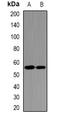 UDP-Glucose 6-Dehydrogenase antibody, orb382110, Biorbyt, Western Blot image 