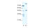 NFS1 Cysteine Desulfurase antibody, 27-792, ProSci, Enzyme Linked Immunosorbent Assay image 